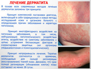 Симптомы дерматита