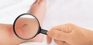Последствия укуса комара